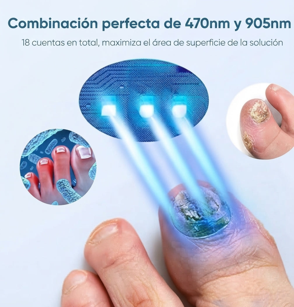 Dispositivo de Fototerapia para el Cuidado de las Uñas