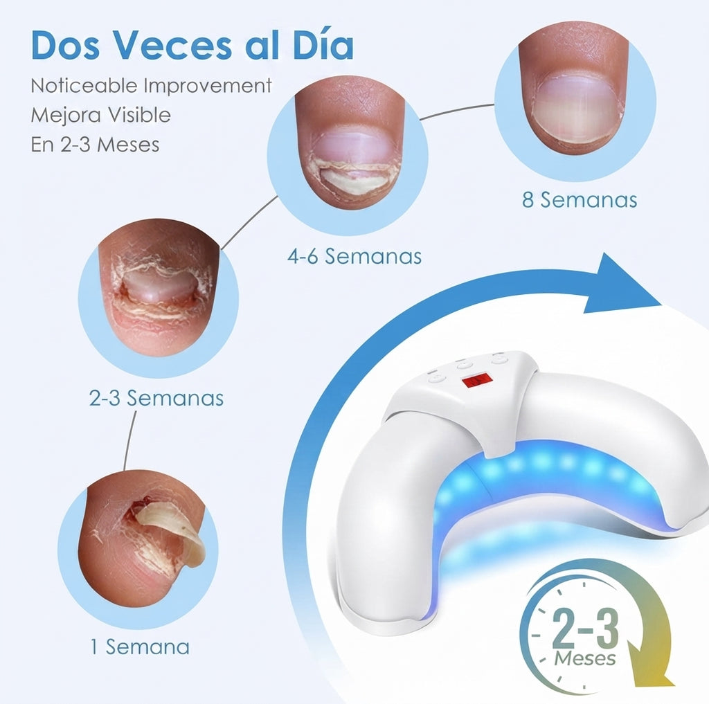 Dispositivo de Fototerapia para el Cuidado de las Uñas